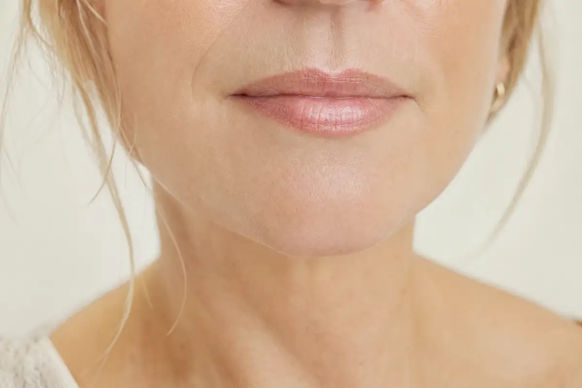 Close-up of the mouth and chin of a woman in her fifties