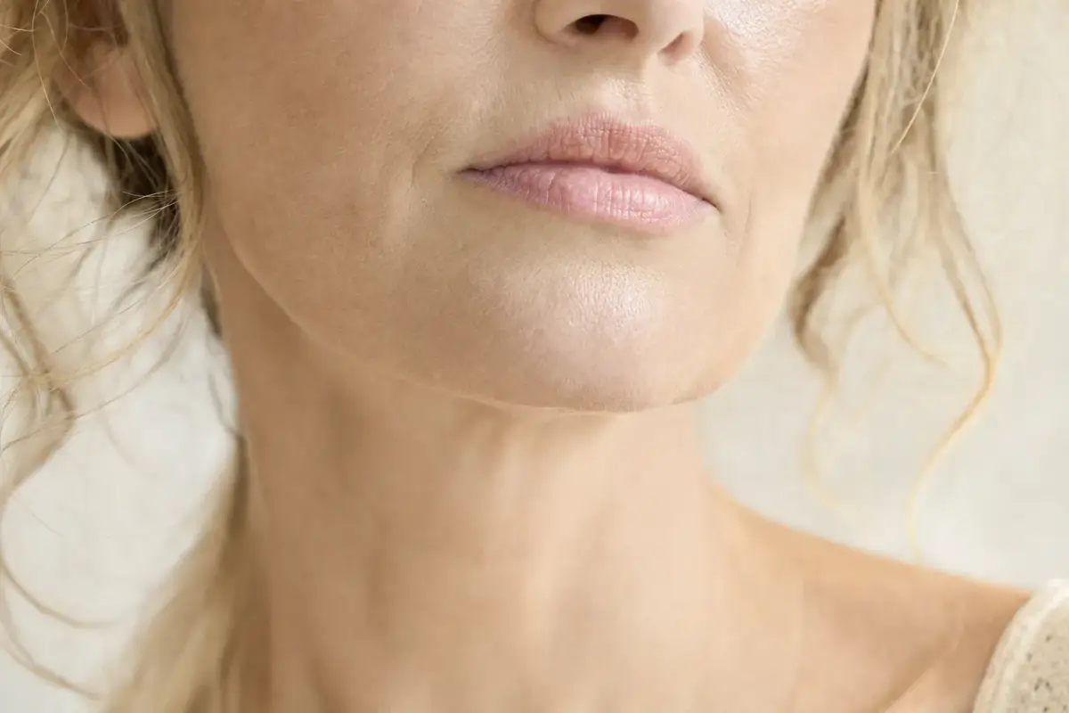 Close-up of the mouth corners and chin of a woman in her fifties